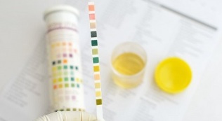 pot fuma înainte de a trece urina pentru analiză